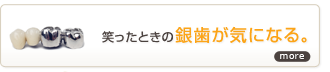 笑ったときの銀歯が気になる